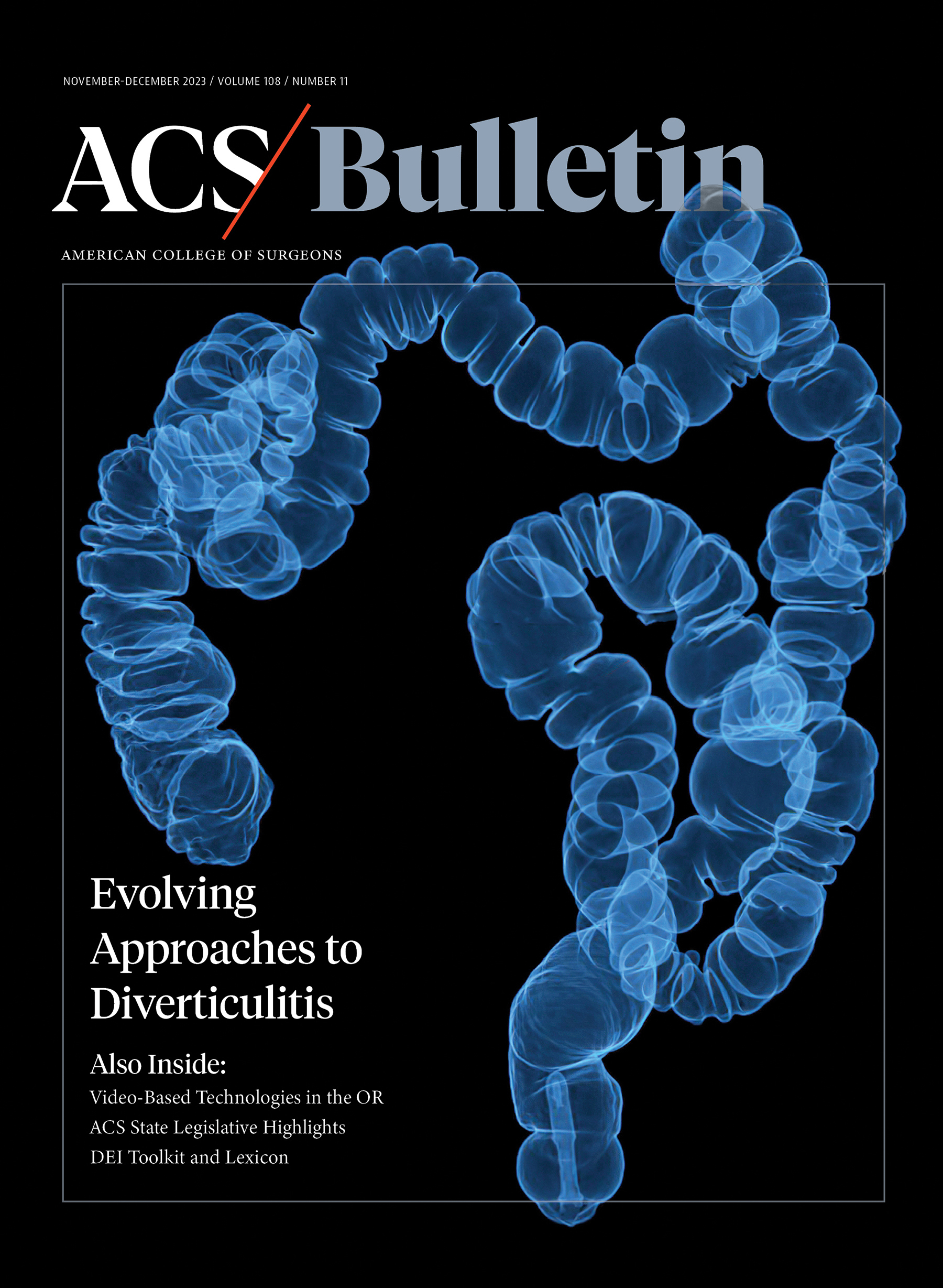 Surgeons Describe Evolving Approaches to Diverticulitis Management in Bulletin