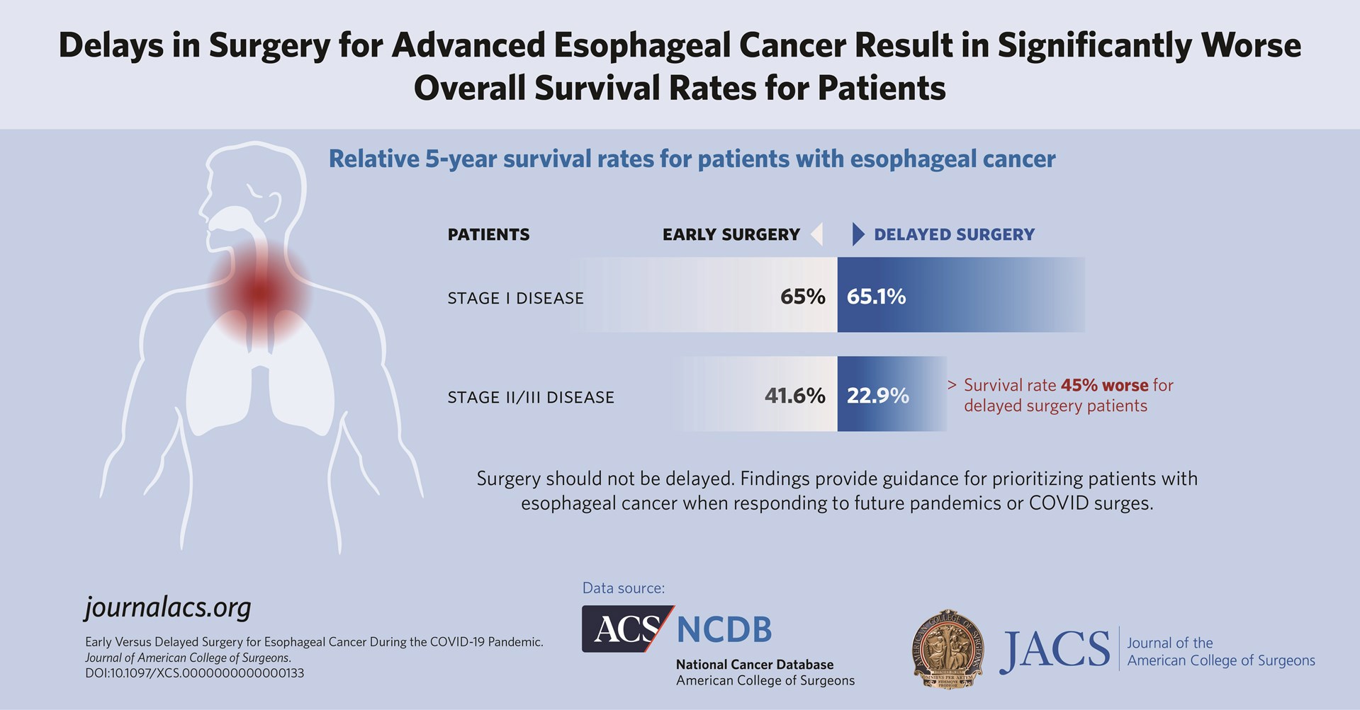 Delays in surgery for advanced esophageal cancer result in