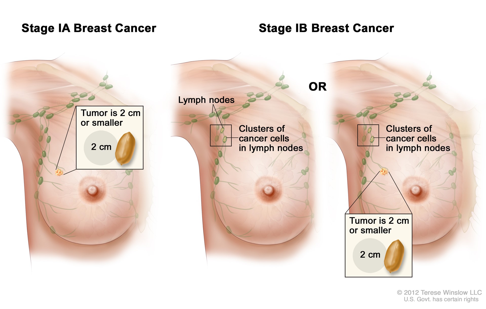 Breast Development and Forms